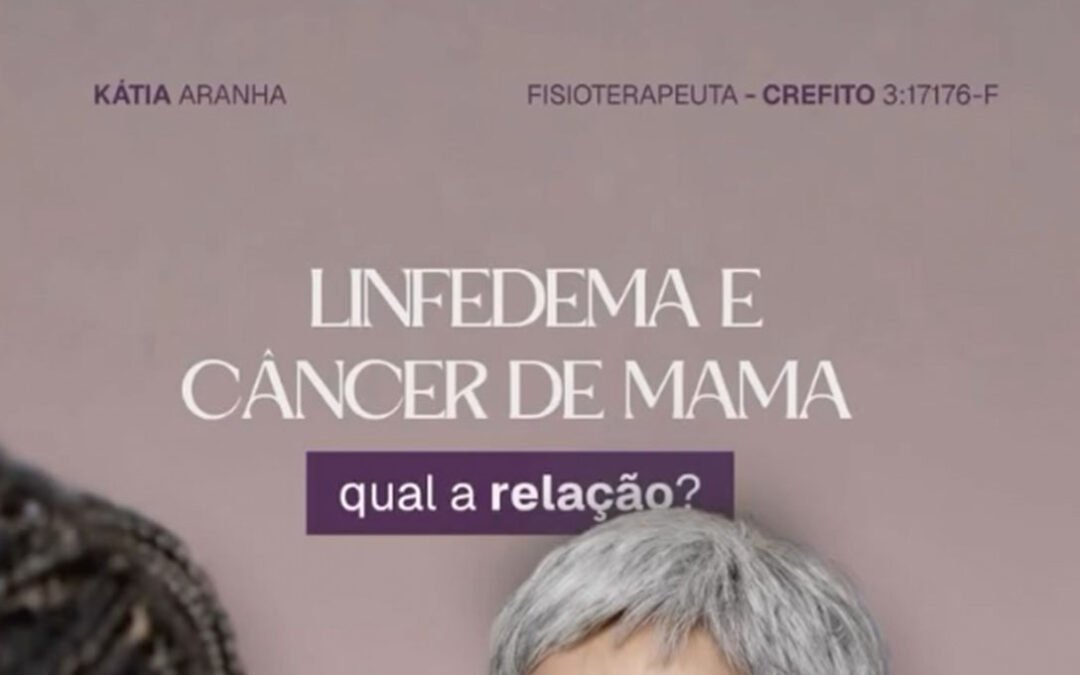 Linfedema após Câncer de Mama: Sintomas e Tratamento